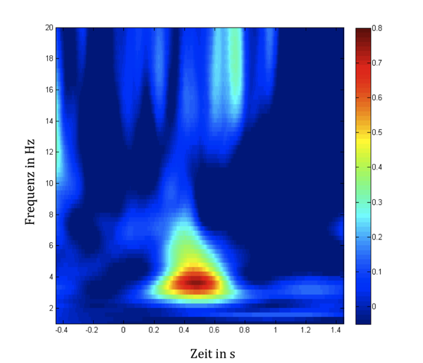 Zeit-Frequenz-Analyse von olfaktorisch ereigniskorrelierten Potentiale